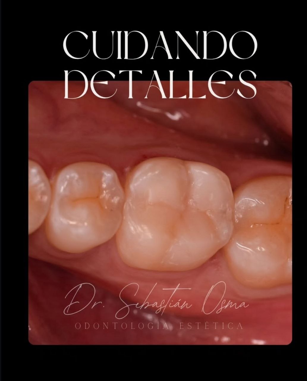 Trabajo de odontología DentArt Family en el norte de Bogotá