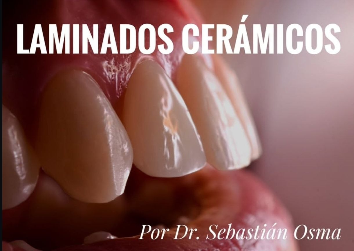 Trabajo de odontología DentArt Family en el norte de Bogotá